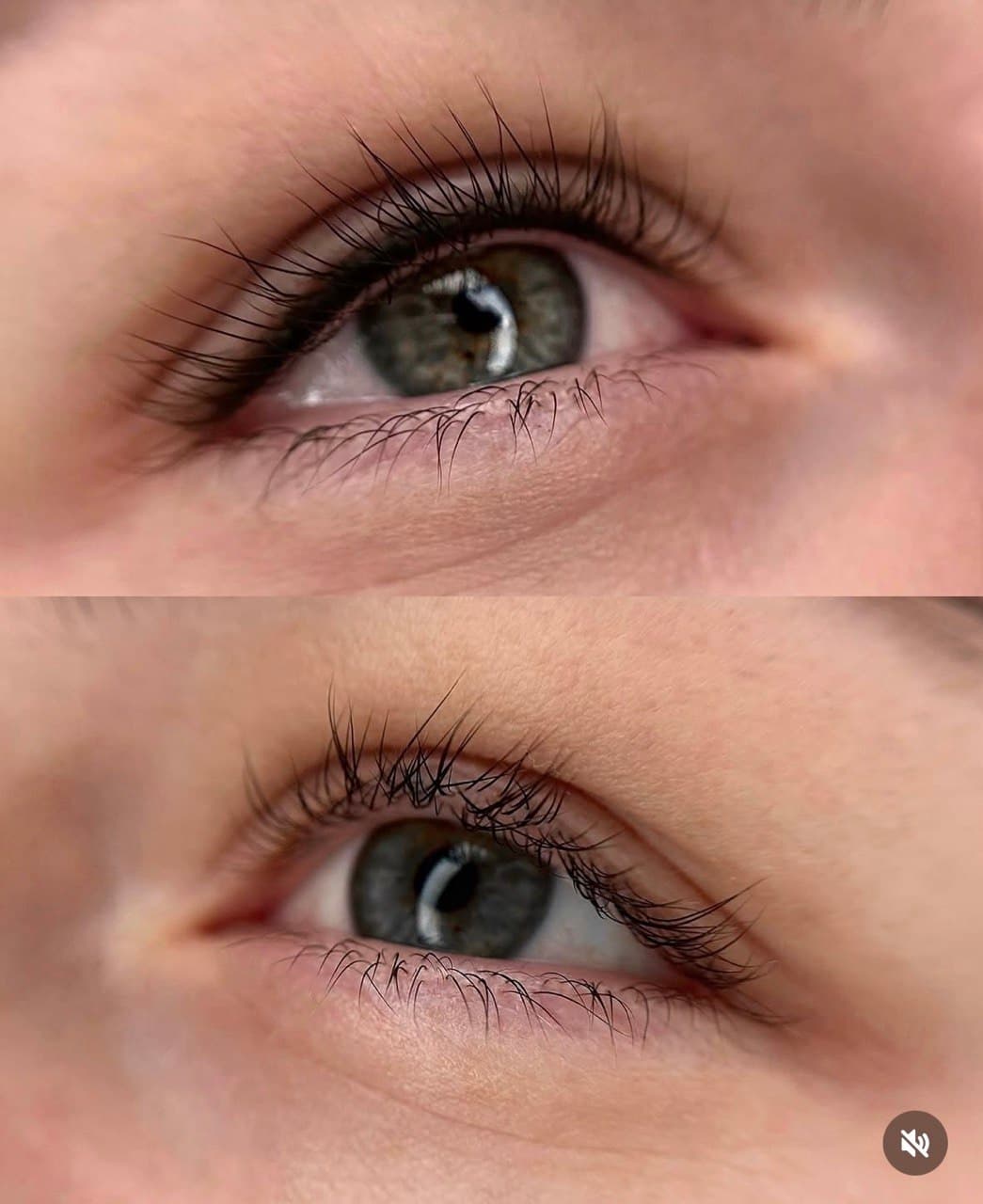 Eyelash Line Enhancement